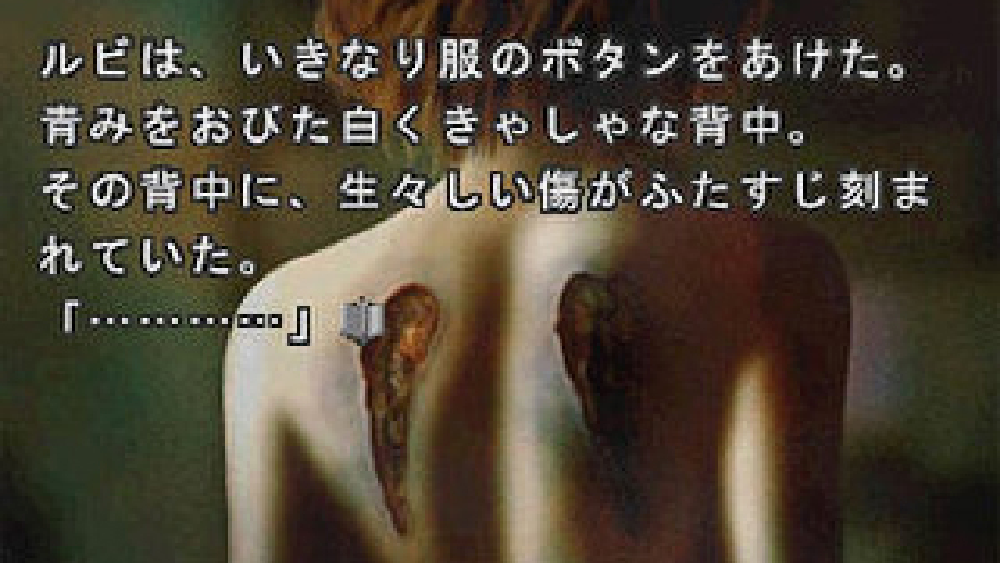 バロックシンドローム